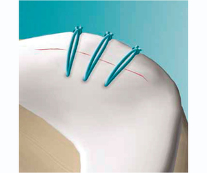 Meniscal Viper